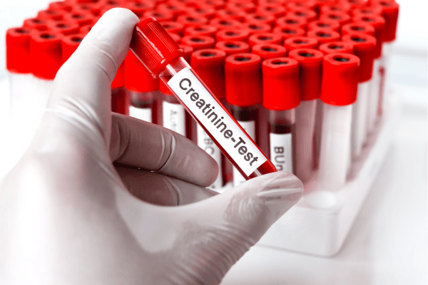What is Creatinine? The Simple Blood Test That Reveals Your Kidney Health